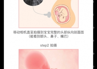 瘦腿相机app合集